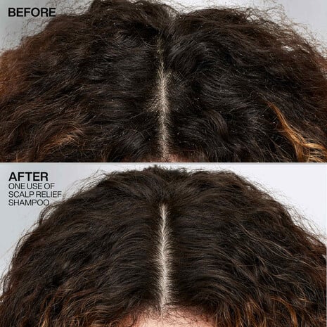 REDKEN Dandruff Control Shampoo