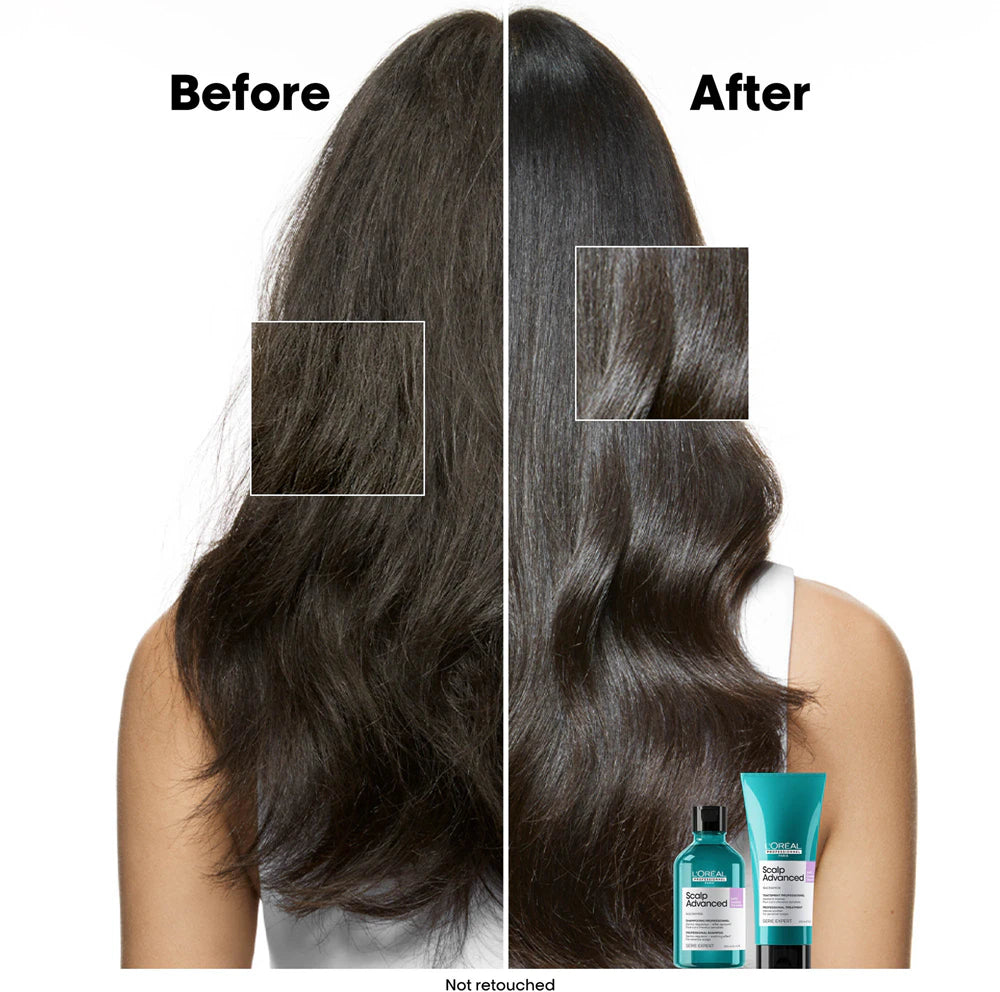 Scalp Advanced Anti-Discomfort Dermo-Regulator Shampoo