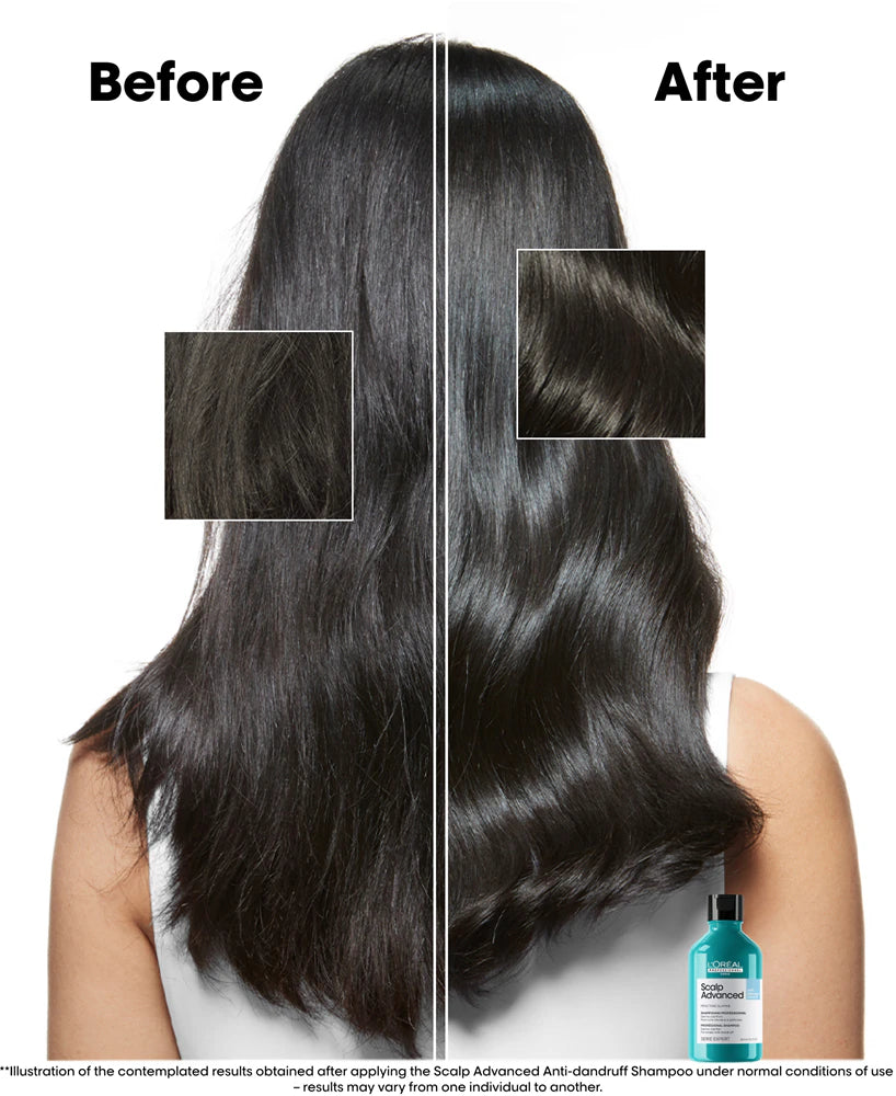 Scalp Advanced Anti-Dandruff Dermo-Clarifier Shampoo
