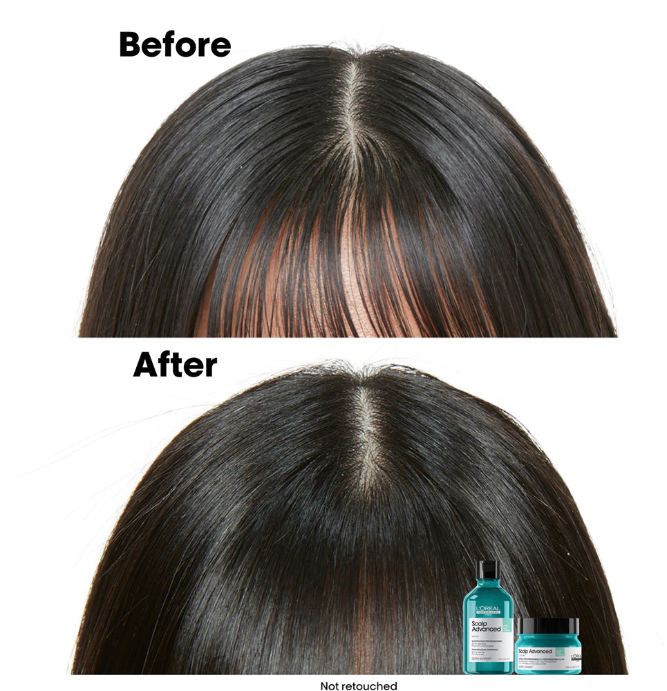 Scalp Advanced Anti-Oiliness 2-in-1 Deep Purifier Clay Mask