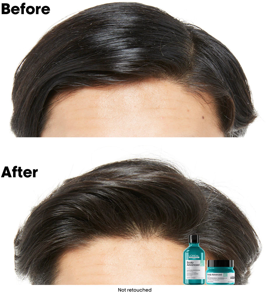 Scalp Advanced Anti-Oiliness 2-in-1 Deep Purifier Clay Mask