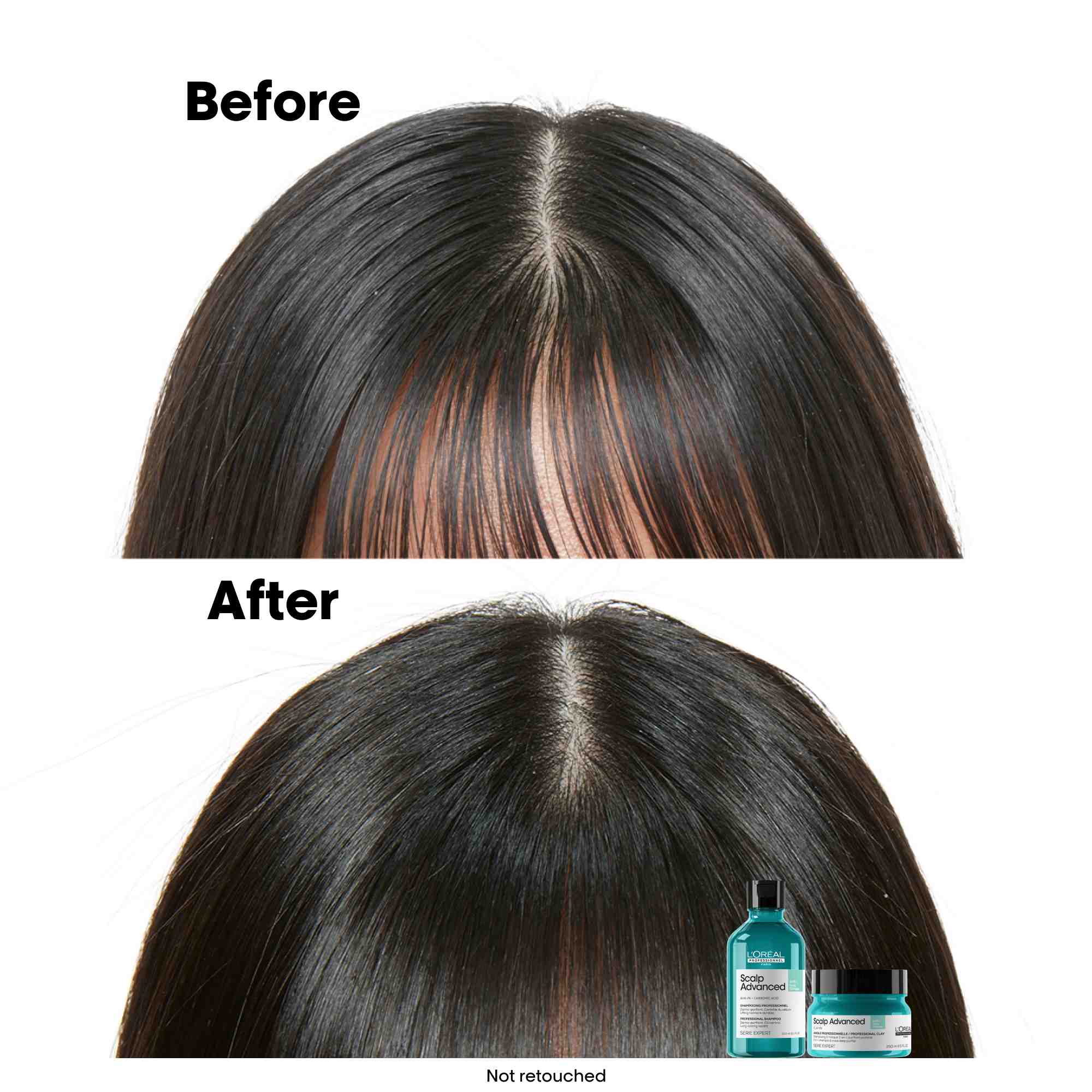 Scalp Advanced Anti-Oiliness Dermo-Purifier Shampoo