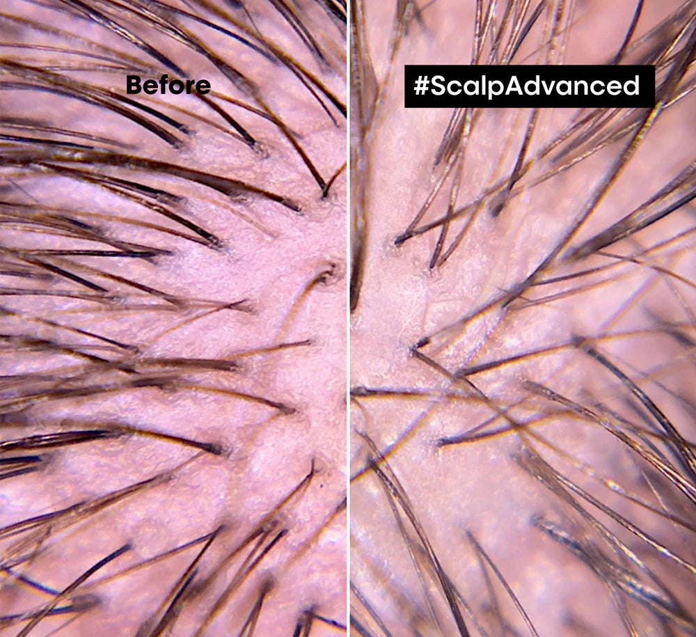 Scalp Advanced Anti-Discomfort Soothing Treatment