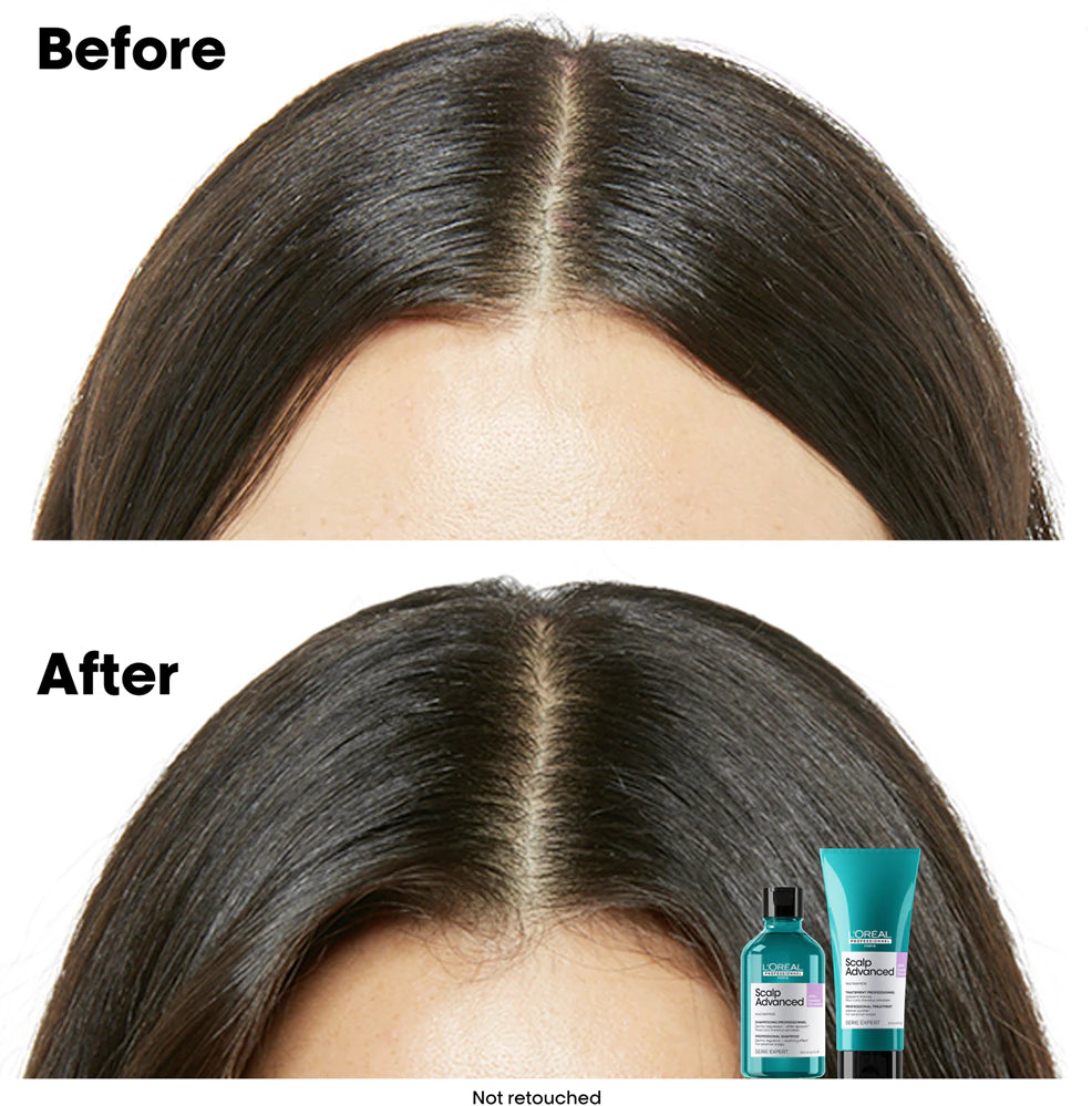 Scalp Advanced Anti-Discomfort Dermo-Regulator Shampoo