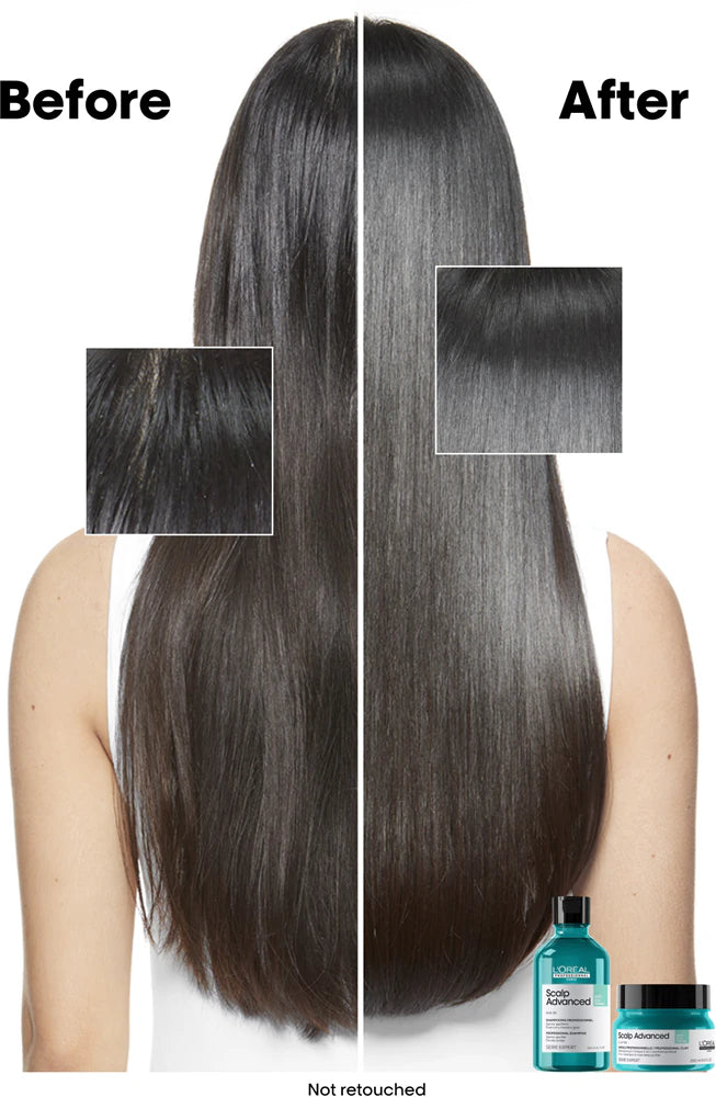 Scalp Advanced Anti-Oiliness 2-in-1 Deep Purifier Clay Mask